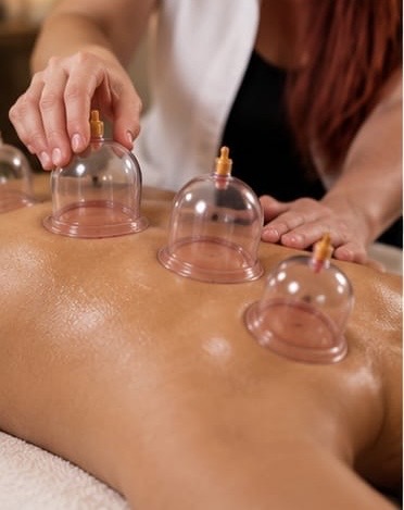 Terapia con ventosas